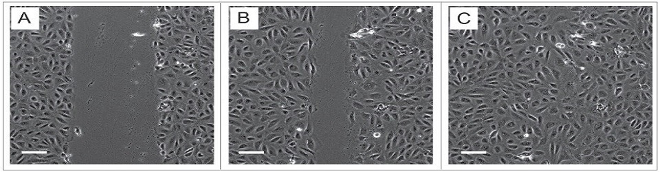 آزمون مهاجرت سلولی (Scratch assay)